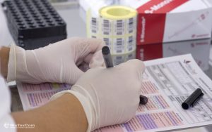 13-CPG-test-tubes-with-blood-samples-immediately-sent-to-the-laboratory